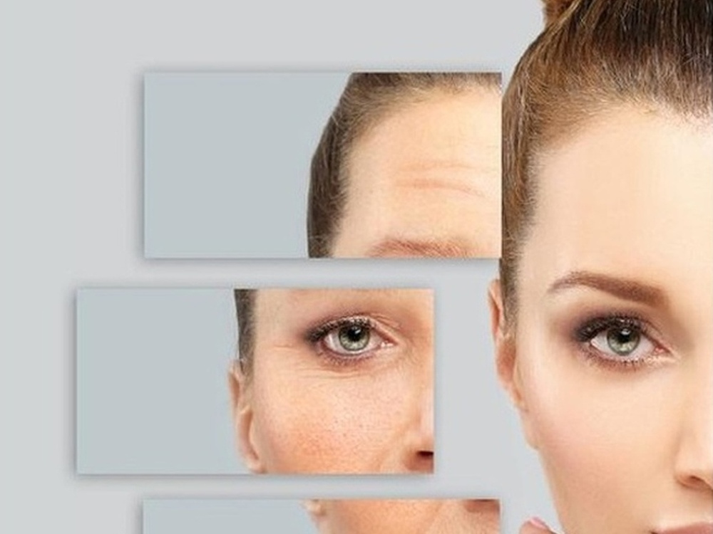 Radiofrequenz, Mikrodermabrasion & Needling
